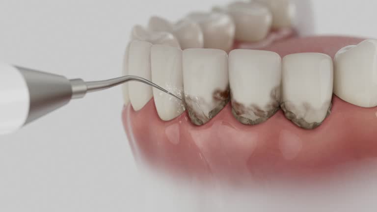 Reliable Dental Implants contractor in Gettysburg, PA by Smile Center Dentistry